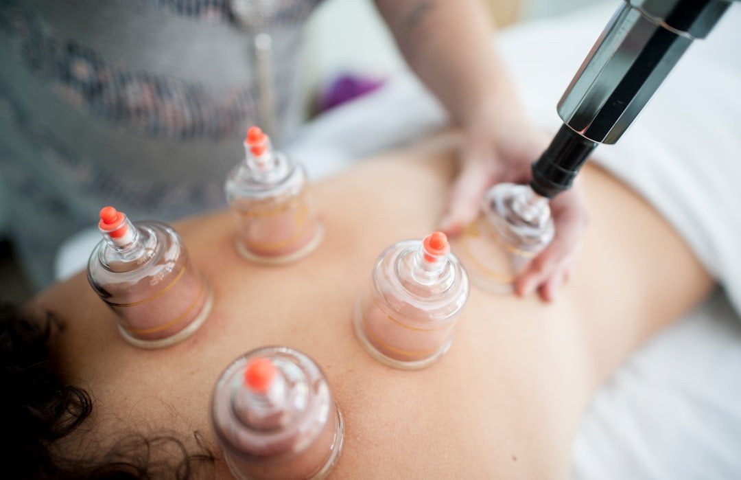 Therapeutic cupping therapy session
